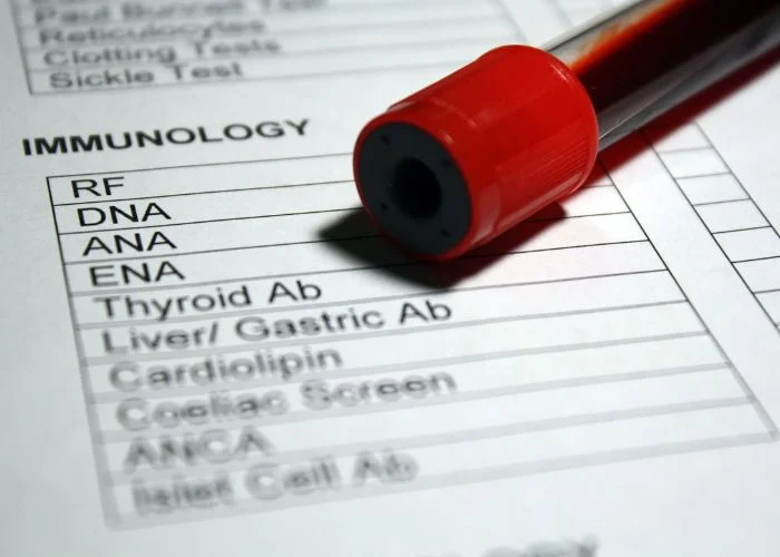 What Blood Work Shows Diabetes